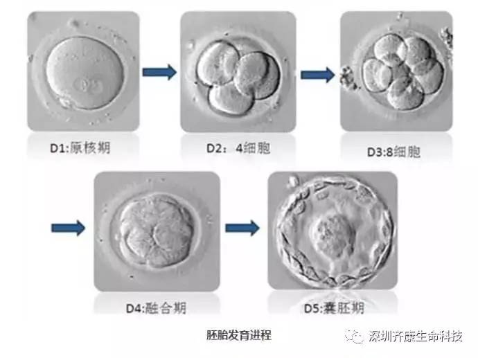 胚胎移植手术