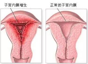 迟迟怀不上孩子？子宫内膜或许就是幕后真凶