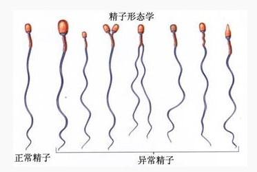 想要提高试管婴儿成功率，这三件事可千万不能忽略