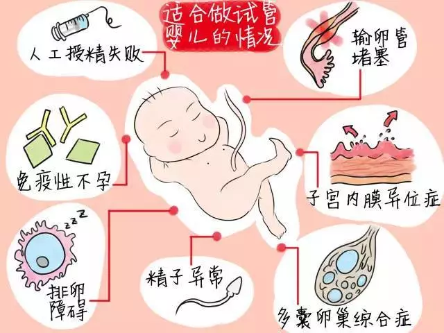 试管婴儿全套流程，3分钟看懂试管婴儿全过程