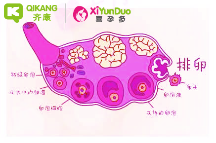 排卵障碍能做试管婴儿吗