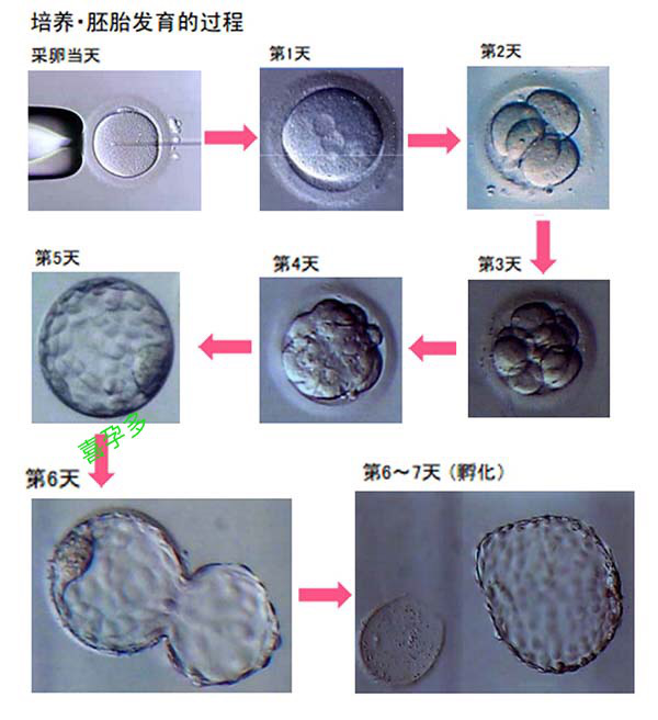 囊胚级别怎么区分？第三代试管婴儿囊胚送检和冷冻标准有什么不同？