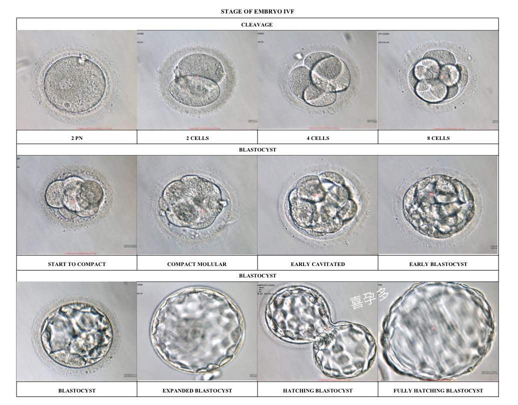 囊胚级别怎么区分？第三代试管婴儿囊胚送检和冷冻标准有什么不同？