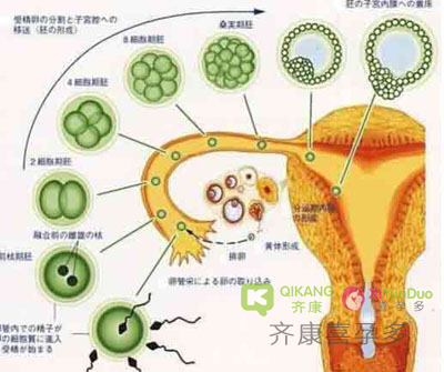 试管婴儿能让因黄体功能不全备孕失败的女性看到希望