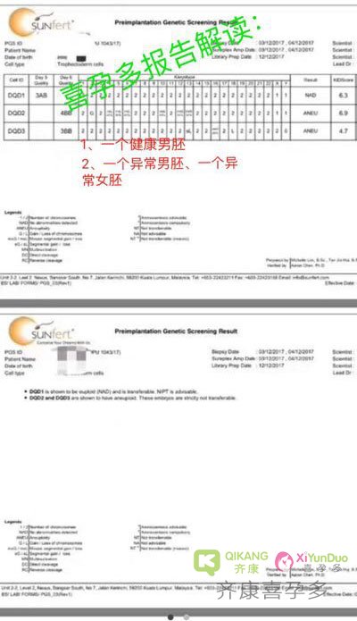 40岁多囊卵巢马来西亚三代试管一次成功