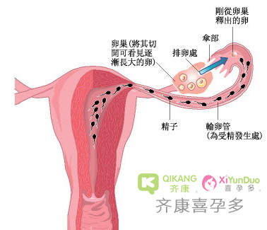 胚胎着床失败