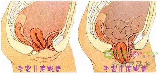 子宫是宝宝胚胎萌芽的宫殿，不管是自然怀孕还是试管，伤害她的行为不要有