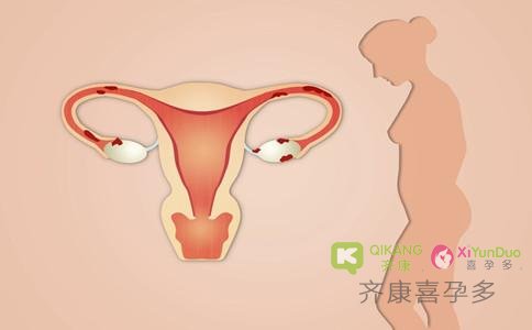 卵巢堵塞是怎么造成的