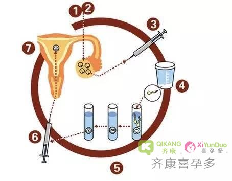 是什么原因导致你试管取卵阶段不理想