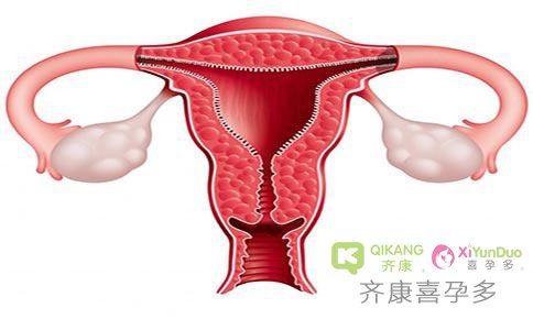 做试管子宫内膜太薄，该如何调理呢？