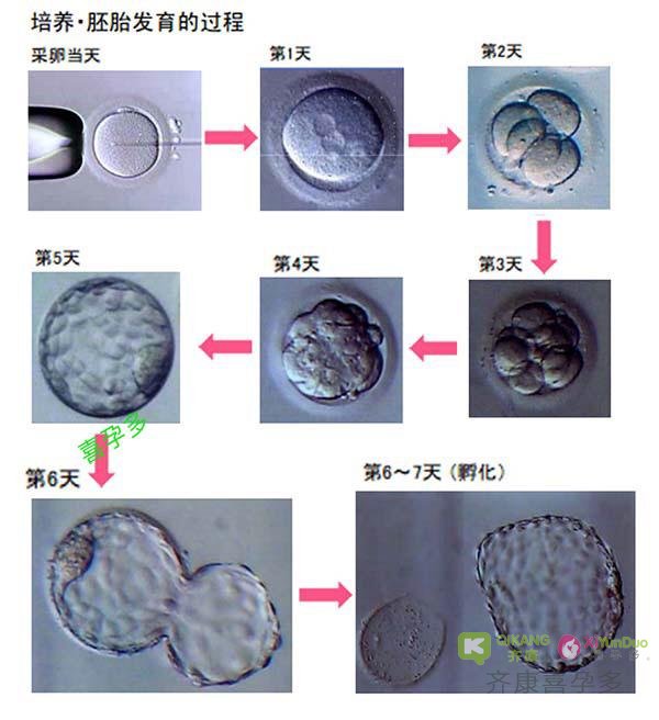 囊胚培养的流程和养囊成功率