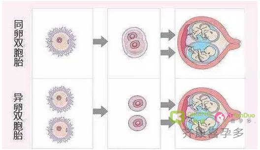 怀双胞胎有哪些风险？