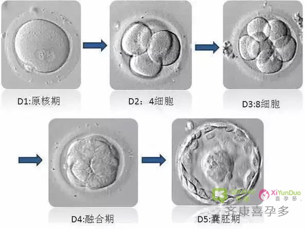 齐康喜孕多助孕小常识--哪些环节会导致试管婴儿失败