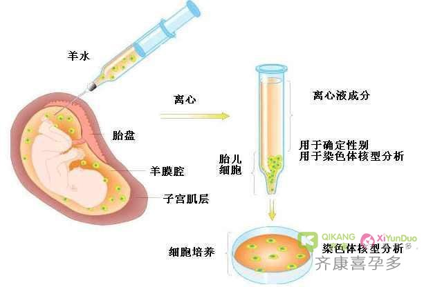 打破偏见，为爱转发！321世界唐氏综合征日