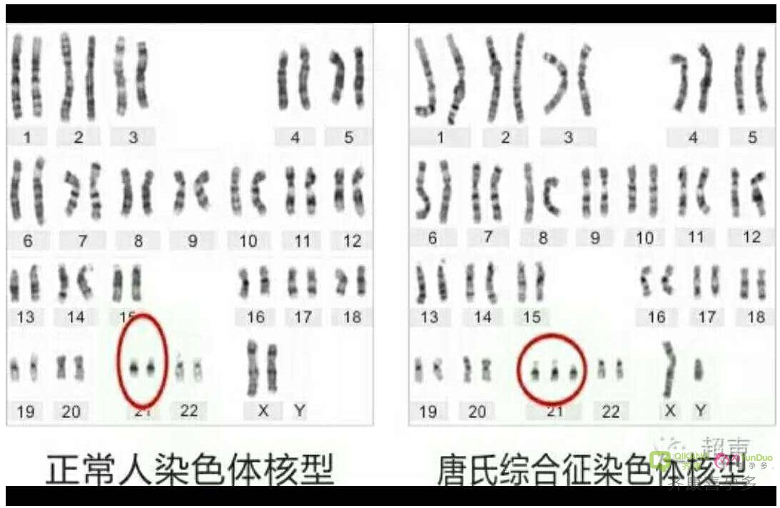 喜孕多小课堂：为什么只听说13.18和21号染色体遗传异常会多一条？