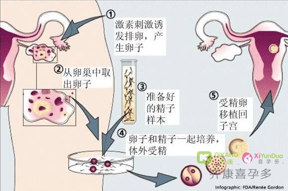 为什么泰国试管都是移植的冻胚，比鲜胚移植强在哪里？