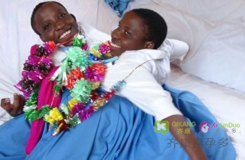 21岁坦桑尼亚连体婴姐妹去世 连体婴儿是怎么造成的
