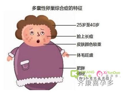 齐康喜孕多孕育小知识：有多囊的女性应该如何科学的备孕