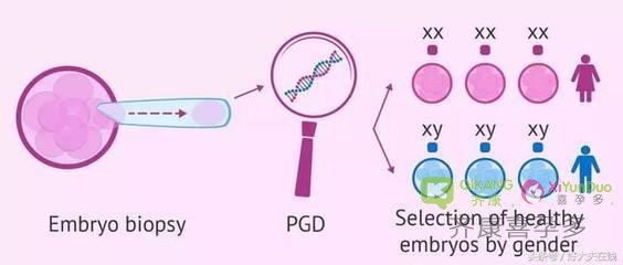 齐康喜孕多海外试管告诉你生男孩的秘诀