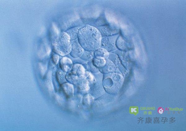 试管婴儿中判断胚胎好坏的一个重要标志---胚胎碎片