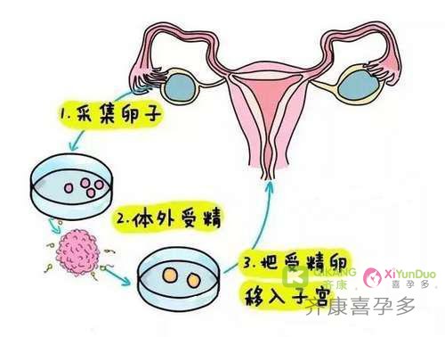 做试管卵子质量的好坏离不开卵子的守护神——颗粒细胞