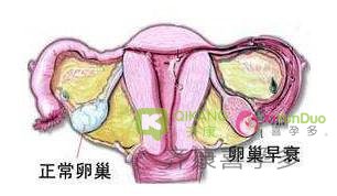 卵巢衰退的表现之一：月经周期变短