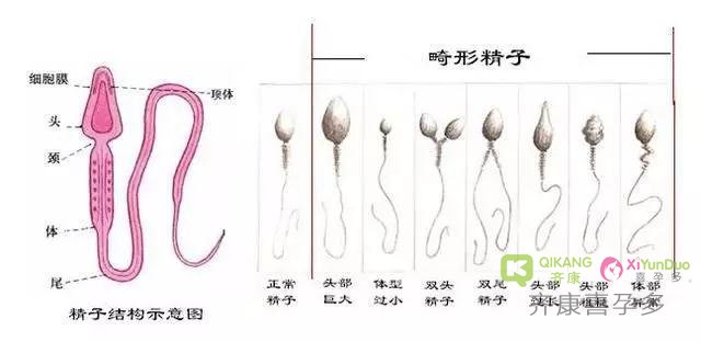 试管前期检查中精液分析报告单有那么多指标要怎么看呢？