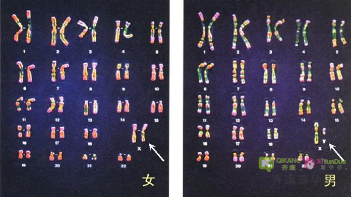 试管前期染色体检查重要吗？做试管染色体检查是否必要？