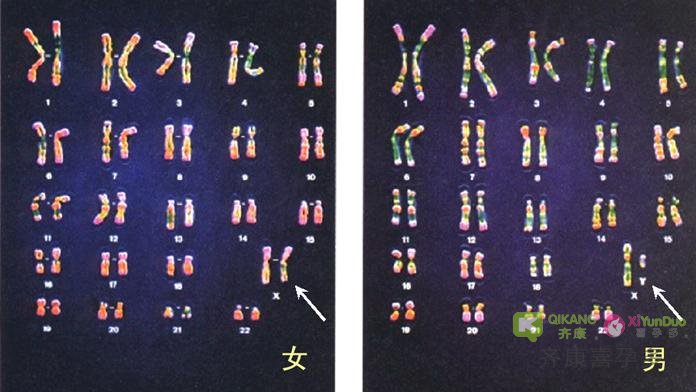 试管前期染色体检查重要吗？做试管染色体检查是否必要？