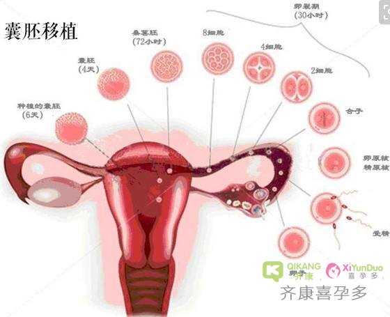 弓形子宫能正常生育吗？弓形子宫是否影响三代试管最后结局？