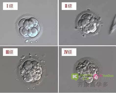 试管婴儿中胚胎培养是怎么一个过程？胚胎等级是如何划分的？