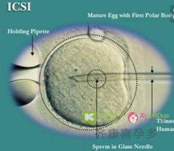 喜孕多小课堂：ICSI和IMSI有什么不同？带你了解试管中单精子注射技术