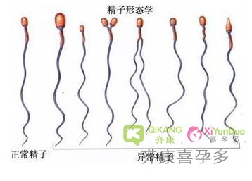 喜孕多小课堂：ICSI和IMSI有什么不同？带你了解试管中单精子注射技术