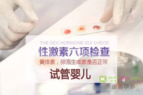 什么是雌性激素六项？试管周期前什么时候检查雌性激素六项？