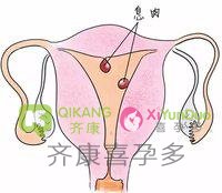 试管中子宫内膜厚度和卵泡大小紧密相关的吗？