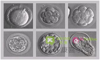 试管婴儿中辅助孵化是怎么回事？哪些人群要用？