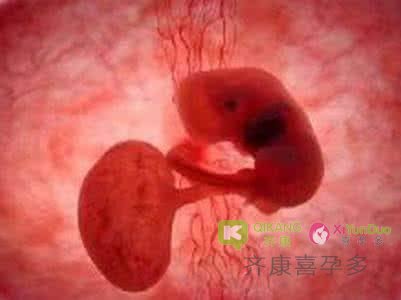 做试管为什么会胎停育？胎心胎芽出现了却胎停的原因是什么？