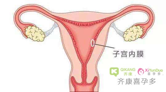 子宫内膜薄调理有用吗？怎么调理才能去做泰国试管？