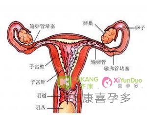 齐康喜孕多泰国试管婴儿专家告诉您输卵管有积水，影响做试管吗？