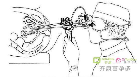 做泰国试管婴儿，碰到子宫内膜薄怎么破？