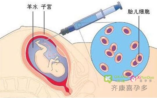 泰国试管婴儿怀孕的妈妈 是否需要做羊水穿刺？