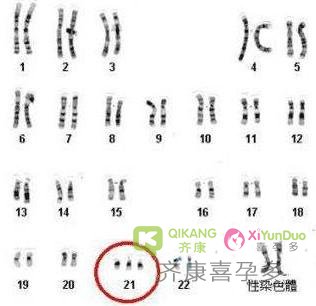 泰国试管婴儿怀孕的妈妈 是否需要做羊水穿刺？