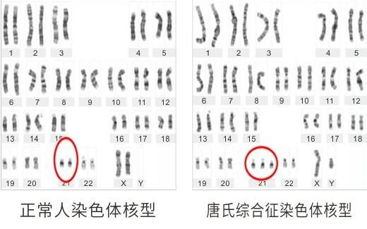 泰国三代试管婴儿囊胚活检筛查 未通过的胚胎为何不能移植？ 囊胚结构变异和数量变异是什么意思？