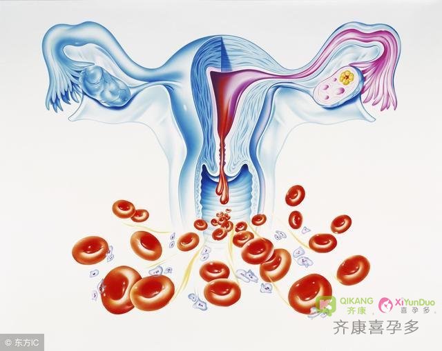齐康喜孕多生殖小课堂：卵巢早衰和月经量的多少有关系吗?