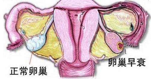 齐康喜孕多生殖小课堂：卵巢早衰和月经量的多少有关系吗?