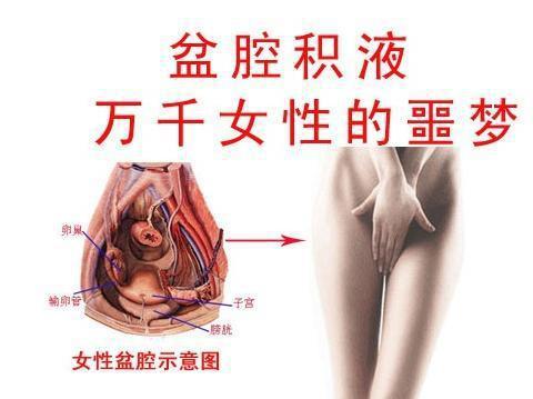 齐康喜孕多生殖小知识：试管婴儿绝对适应症的几种病症（一）