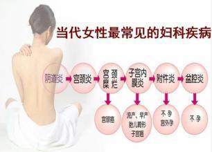 齐康喜孕多告诉你如何远离妇科疾病