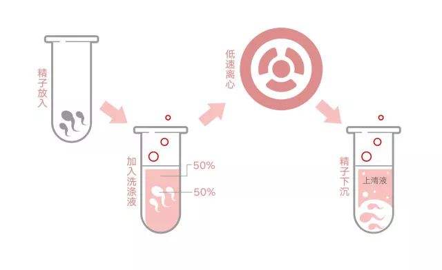 HIV感染者可以通过洗精做试管吗？海外试管婴儿洗精技术你了解多少?