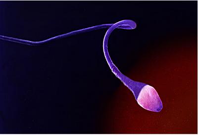 试管婴儿知识分享：精子的畸形率到底对生育有多大的影响？