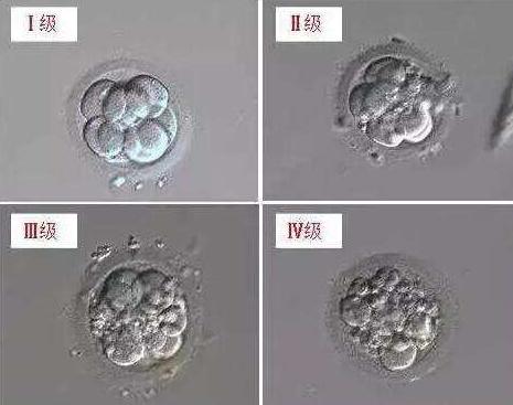 同时移植优质胚胎和非优质胚胎  对试管婴儿最终成功率的影响